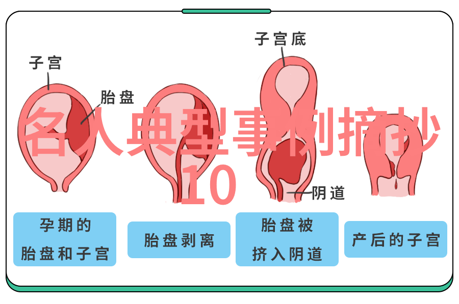 三体黑暗森林中的智慧追逐探索文明生存的无尽迷雾